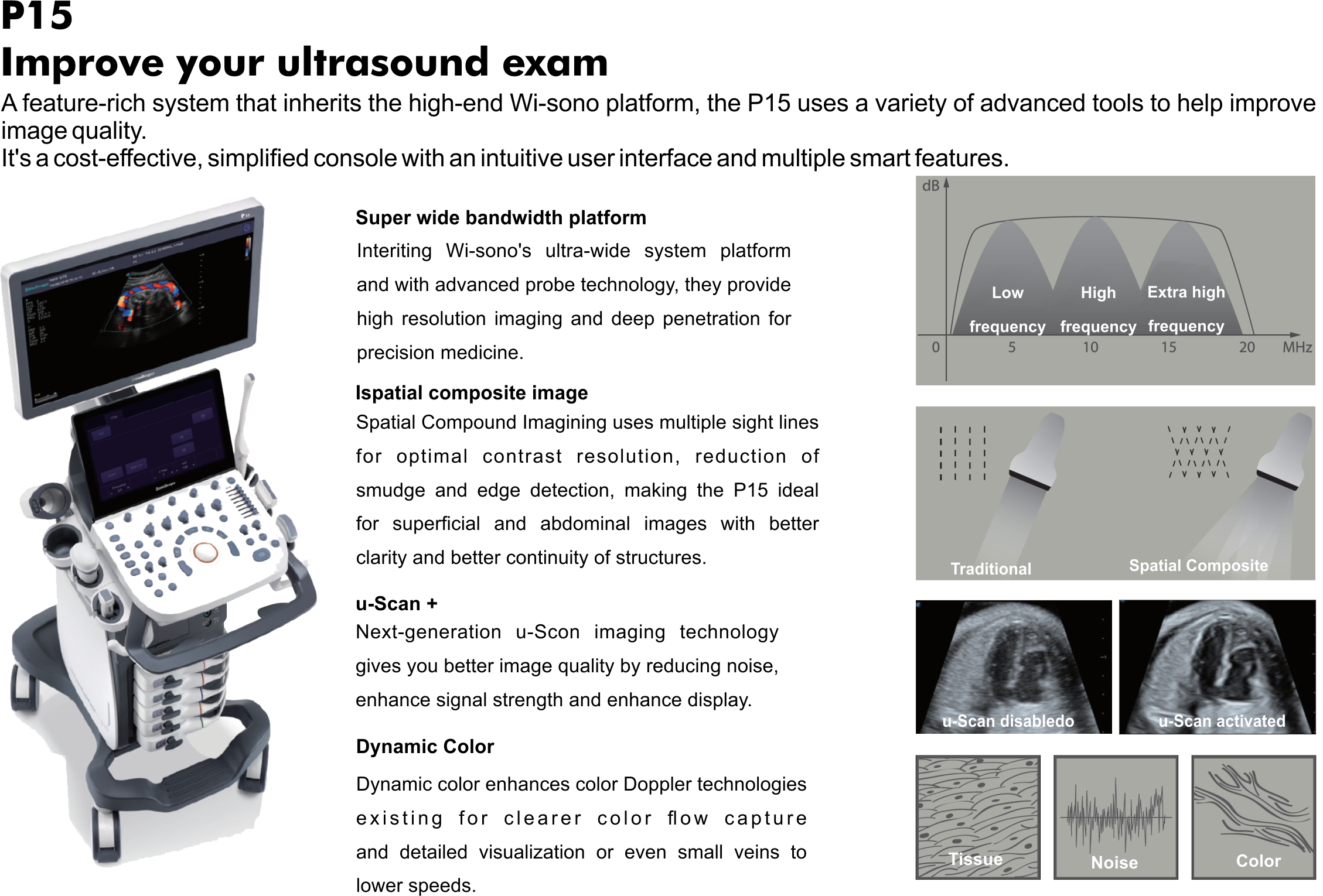 A-1 Improve your ultrasound exam.png